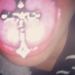 bleed